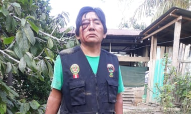 Herli Huanqui after he was attacked by land thieves in July 2022, in Santa Rita Baja.