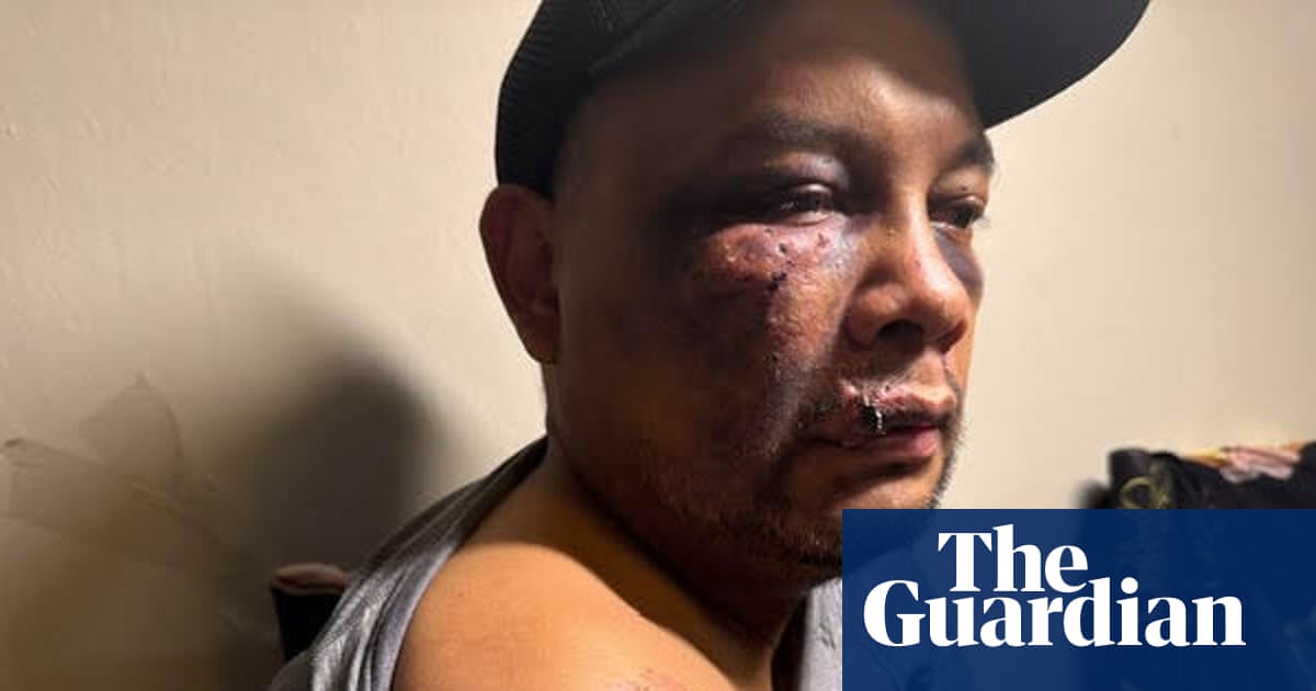 Man suffered brain injury and severe bruising after ICE arrest in Virginia, records show