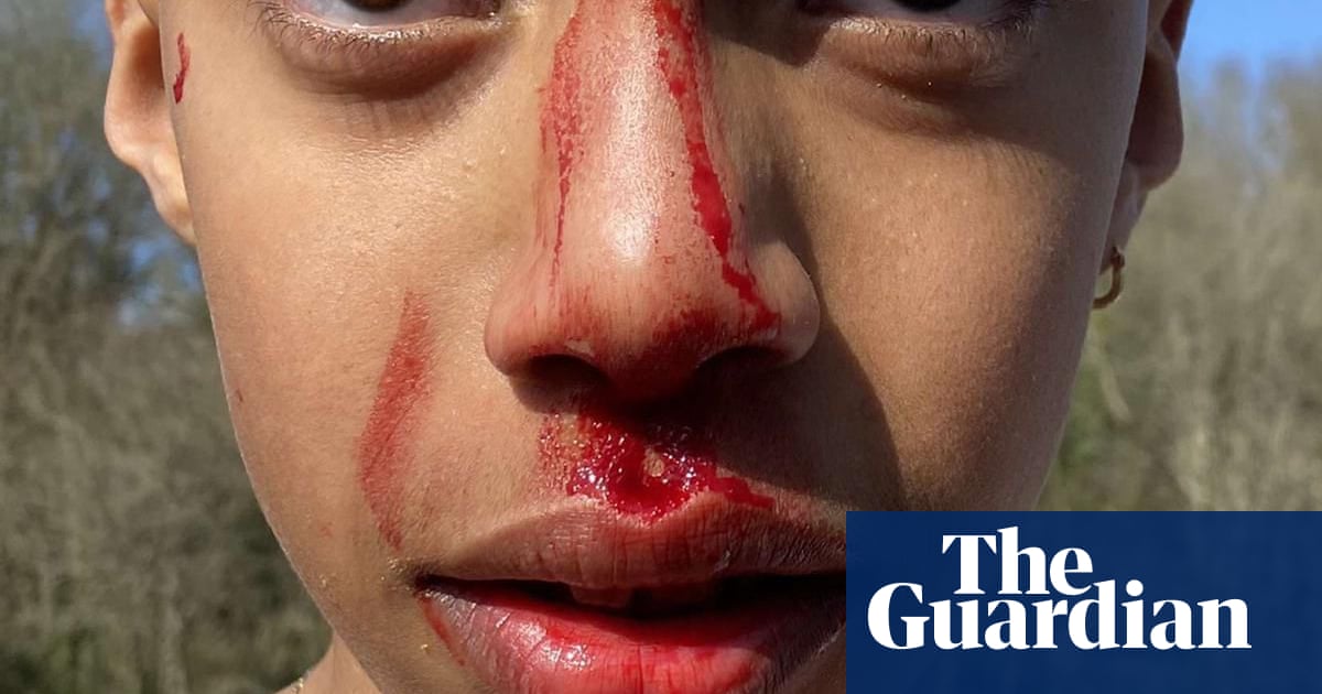 Woman handed suspended sentence for paddle assault on boy in Bristol - The Guardian