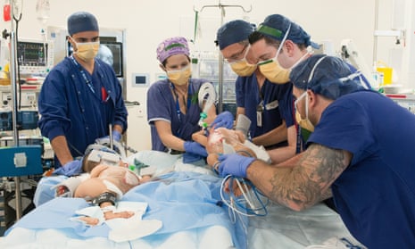 Conjoined twins Nima and Dawa during the successful separation surgery