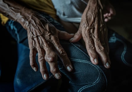 85 year old, Remy Fernandez’s hands