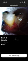 Screenshot from inside reviewerâÂÂs mouth using the Dyson CameraJet toothbrush.
