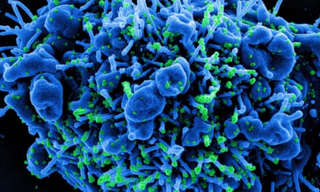 An undated handout image captured and color-enhanced at the National Institute of Allergy and Infectious Diseases shows a colorized scanning electron micrograph of an apoptotic cell (blue) infected with Sars-COV-2 virus particles (green).