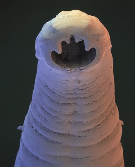 A hookworm, an intestinal parasite, seen under a microscope.