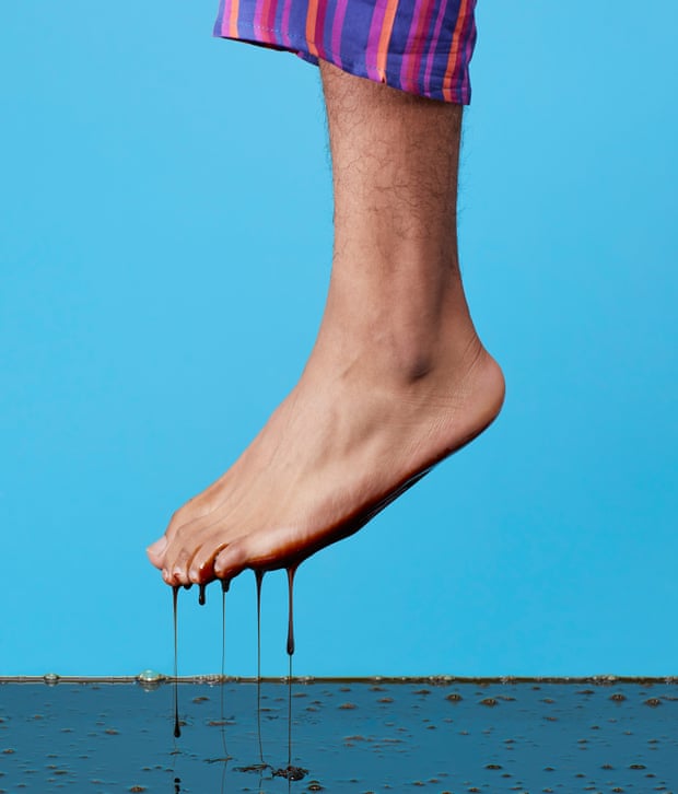 One leg of man wearing pyjama bottoms with bare foot dripping treacle