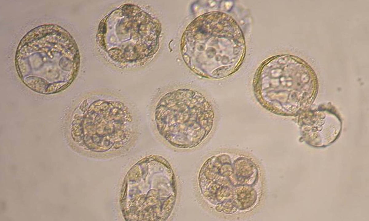 stem cell research should be allowed Researchers in the uk are now allowed to use early stage human embryos for therapeutic purposes, mainly to retrieve stem cells this decision comes amidst a heated debate regarding the medical and economic potential of stem cell research as against its ethical pitfalls. stem cell research should be allowed Researchers in the uk are now allowed to use early stage human embryos for therapeutic purposes, mainly to retrieve stem cells this decision comes amidst a heated debate regarding the medical and economic potential of stem cell research as against its ethical pitfalls.