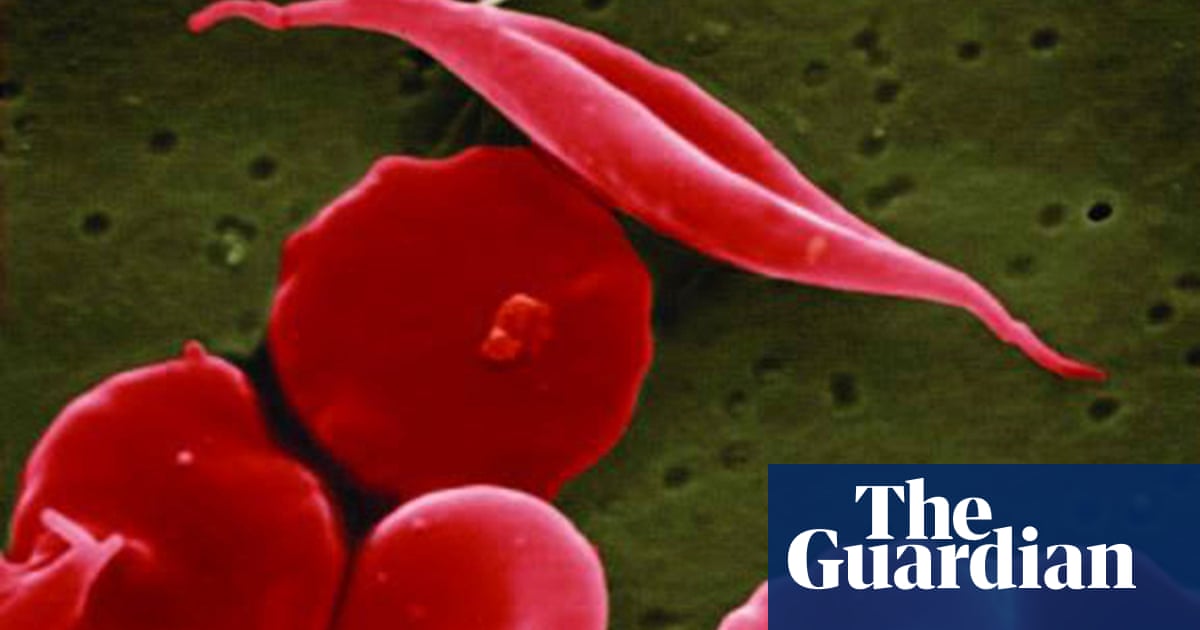 Кръвно заболяване което може да доведе до преждевременна смърт засяга