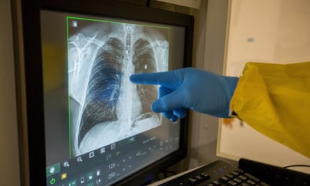 A doctor at the polyclinic Klinicare performs an x-ray of the lungs of a potential patient with COVID-19 in Brussels