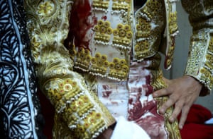 The bloodied Colombian bullfighter Juan de Castilla rests at the Macarena bullring in Medellin, Colombia