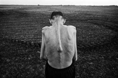 A black and white image of Fabián Tomasi, showing his emaciated frame as he stands with his back to the camera