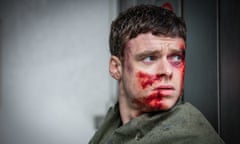 Richard Madden in character as David Budd, who looks concerned while covered in blood