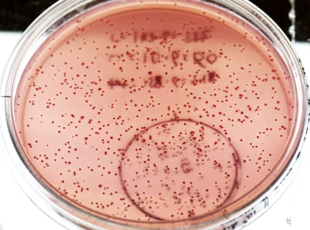 Células de cor rosa contidas em uma placa de Petri, parte da qual é anelada e rotulada