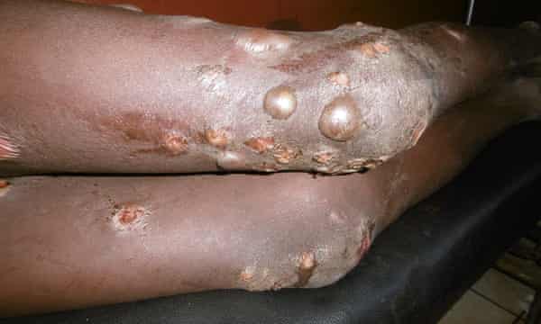 Injuries that form part of the complaint filed by three human rights groups against Glencore UK.