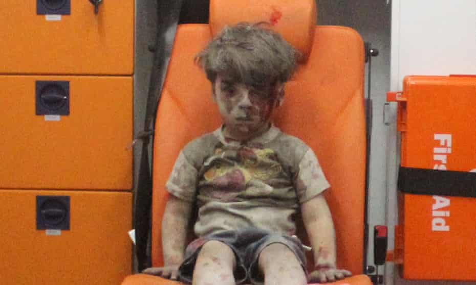 Omran Daqneesh was depicted stunned and sitting alone in the back of an ambulance after an airstrike.