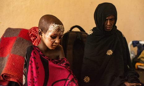 A child who suffered from burns from shelling sits with a woman, Abala, northern Afar, Ethiopia.