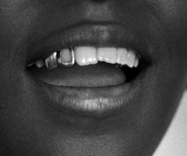 Black and white close-up photograph of a person’s mouth open and smiling. The person wears grills on their teeth.