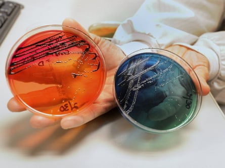Salmonella cultures grown in a laboratory
