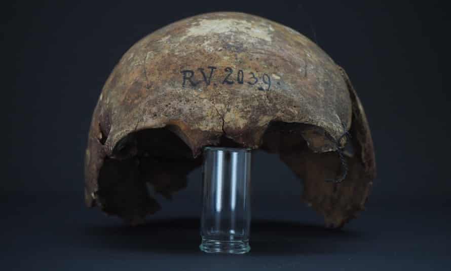 The skull bones of the man buried in Riņņukalns, Latvia, around 5,000 years ago.