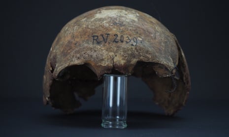 The skull bones of the man buried in Riņņukalns, Latvia, around 5,000 years ago.