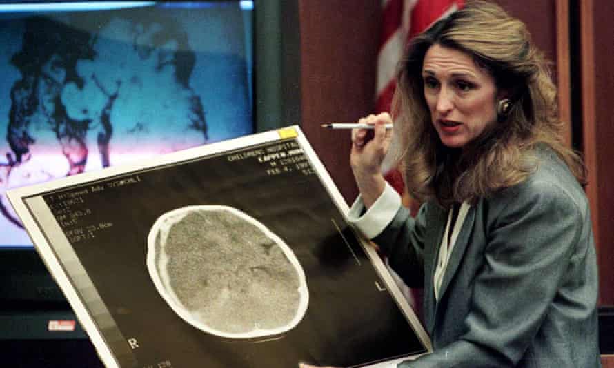 A neuro-radiologist presenting a brain scan during the trial of Louise Woodward in 1997.