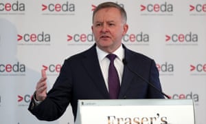 Anthony Albanese