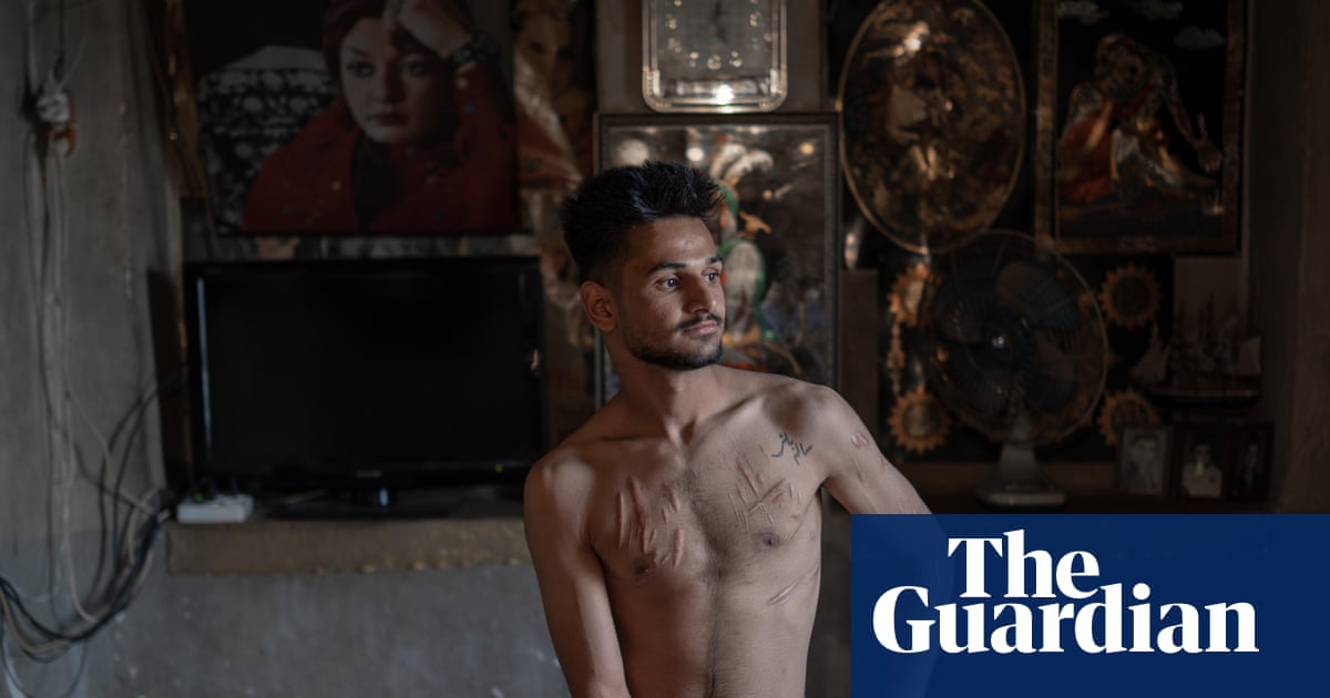 A man from Shiraz bares his scars: Shayan Sajadian's best photograph