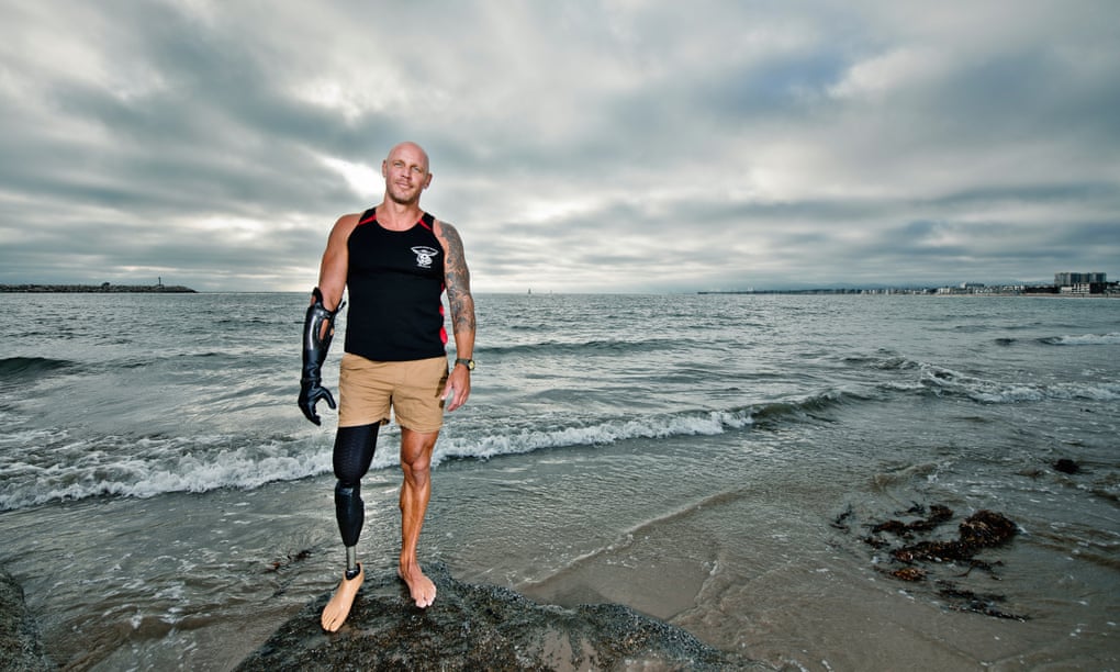 Paul de Gelder, in shorts and a vest, with his prosthetic right arm and right leg, and with the sea and sky behind him