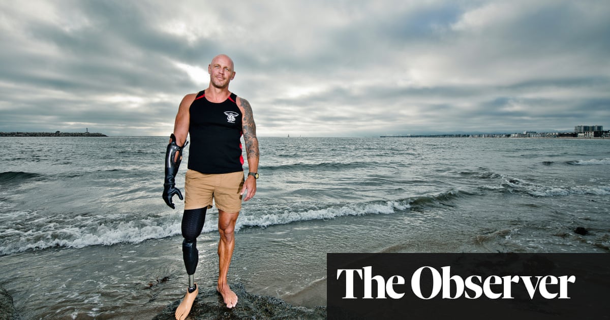 ‘A shark bit my arm and leg off. Now I want to save the species’