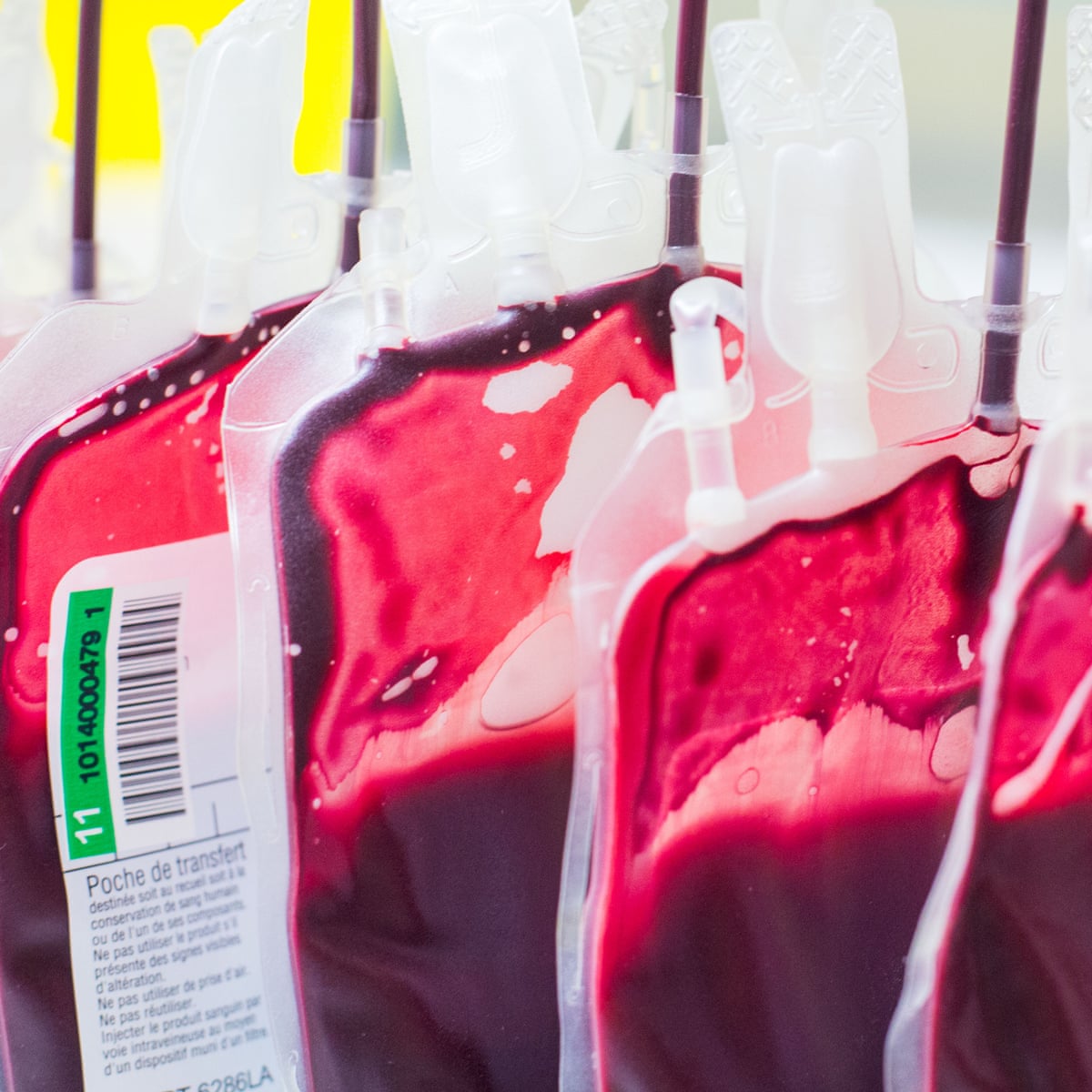 Coronavirus Survivors Blood Plasma Could Be Used To Fight Infection Science The Guardian