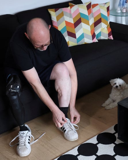 Walter Benjamin sits on a sofa and ties his shoelaces. His right leg is prosthetic and his left is scarred