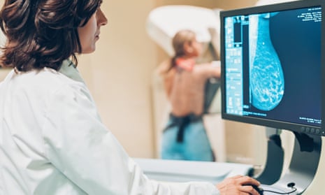 A woman undergoes a mammography