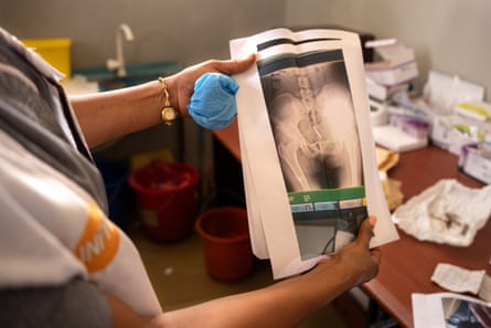 A woman whose face cannot be seen holds up a sheaf of papers; the top one is an X-ray in which a large curved object can be seen within the pelvic bones of a patient. Behind her hands is a table on which can be seen various objects including a crumpled piece of paper on which rusty screws have been placed.
