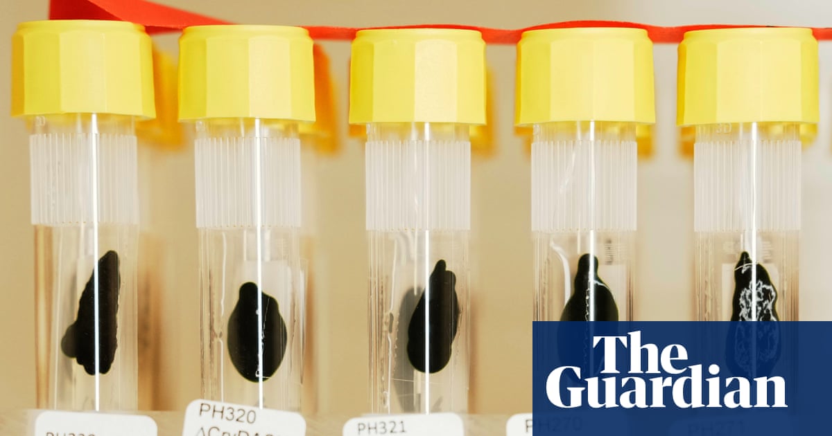 The humble one-celled alga that helped scientists win the Nobel prize