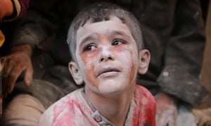 A wounded Syrian child cries in Aleppo, Syria on October 11, 2016.