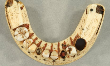 George Washington’s lower denture: note the hole for his only surviving tooth to poke through.