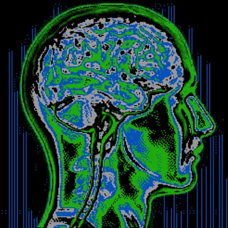 Pixel-art brain scan showing a human head in profile