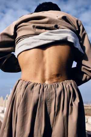 Arbil Taymour Abdullah, 15, the only survivor of village execution, shows his bullet wound.