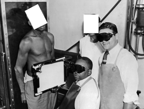 An African American man being X-rayed for the racist, government-funded Tuskegee experiment