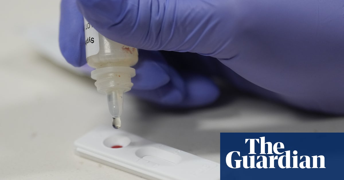 Trump administration axes key STI lab amid dramatic rise in US syphilis cases