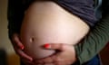 The number of women dying during pregnancy or soon after childbirth has reached its highest level in almost 20 years, according to data from a major UK study, conducted by MBRRACE-UK. Experts said the figures raise "further concern" about maternity services and called for matters such as pre-pregnancy health and personalised care to be "prioritised as a matter of urgency".