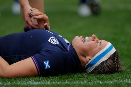 The Scotland captain, Rachel Malcolm, seems in pain as she shows off one of the innovative new mouthguards that can measure and signal a potential concussion.