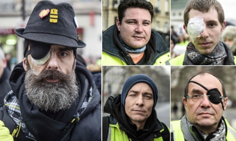 Jerome Rodrigues (L), one of the leading figures of the gilets jaunes movement, and four other protesters who claim to have been injured by police in recent months. 