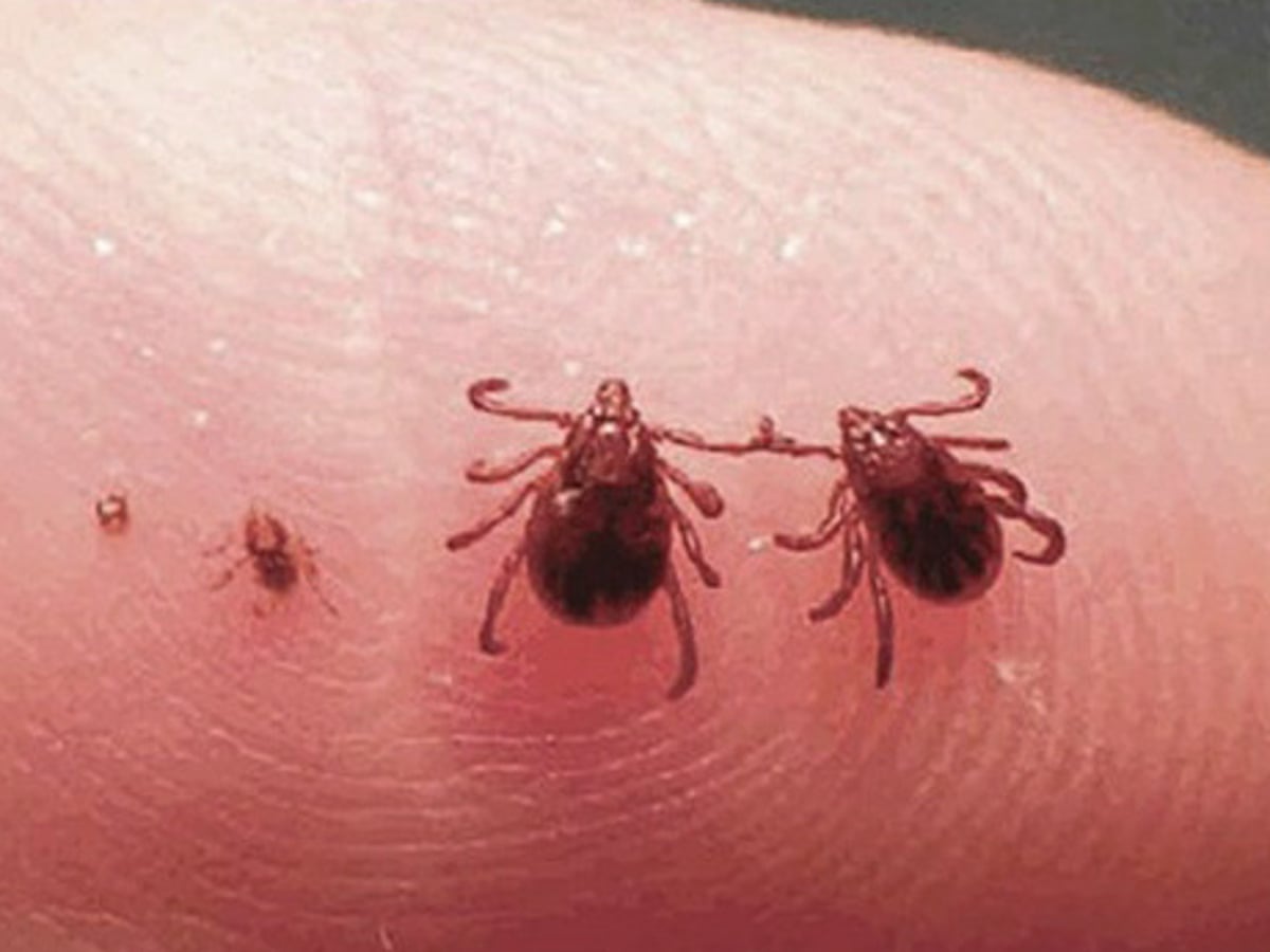 Are Dog Ticks Dangerous To Humans