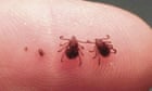 Study finds ticks choose