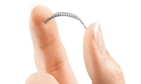 The contraceptive implant Essure. Manufacturers have been withdrawing it from markets worldwide after reports of problems from thousands of women. Composite: The Guardian design team/AP