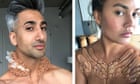 Growth potential: celebrities sprout skin 'implants' for New York fashion week