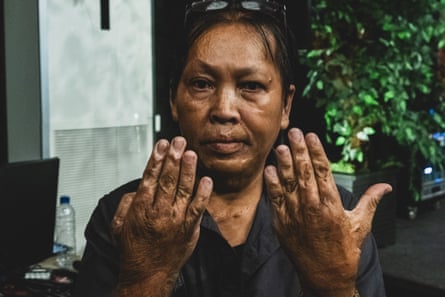 Husnul Khotimah, an Indonesian survivor of the 2002 Bali bombings.