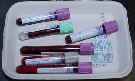 Vials containing blood