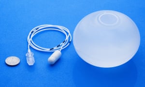 What is the least invasive weight loss surgery