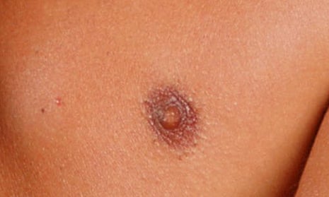 Close up of a nipple